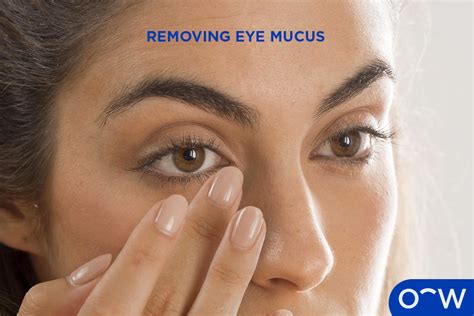 Eye Discharge: Definition, Causes, Symptoms, Treatments and Prevention