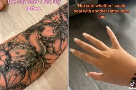 Infected Tattoos Before And After