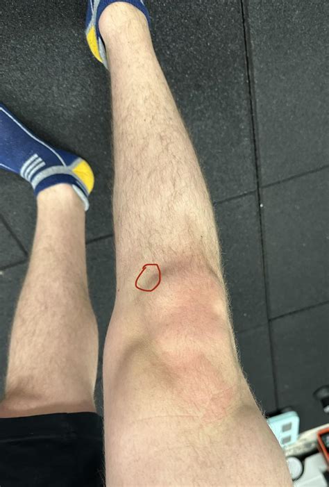 Why Does It Hurt Bending My Knee at Grace Reinhold blog