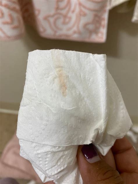 5dpo Spotting? TMI picture | BabyCenter