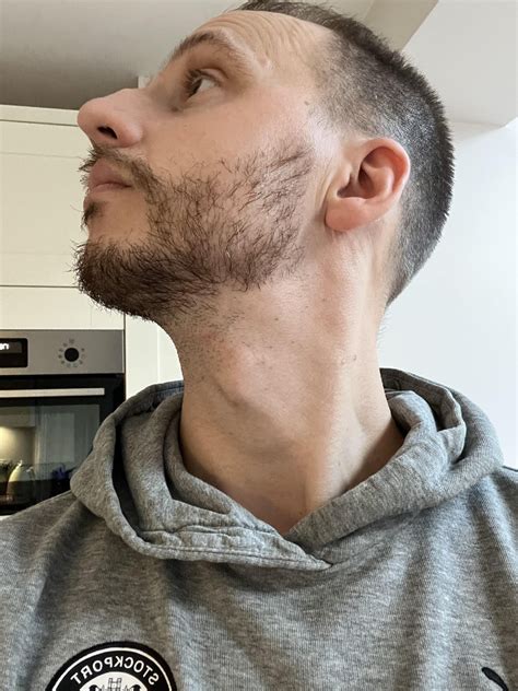 Beard neck line : r/beard
