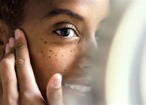 How To Get Rid Of Dark Spots On Eyelids | Makeupview.co