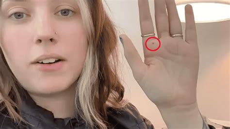 AI Surprises: From Love Advice to Skin Cancer Warning - Fusion Chat