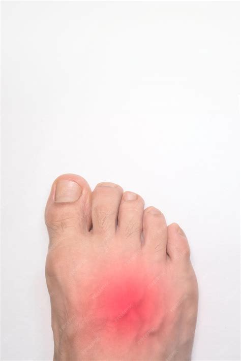 Premium Photo | Instep of a person right foot with a red mark ...