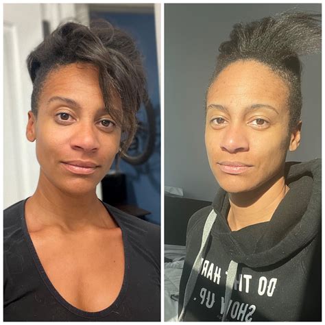 Anyone else loving that winter jaundice look? 😂 People asking if I’m ...