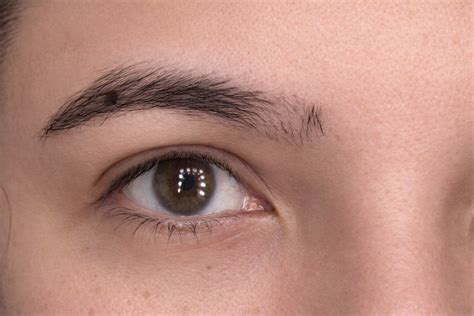 How to Fix a Bald Spot in the Eyebrow? Causes Explained