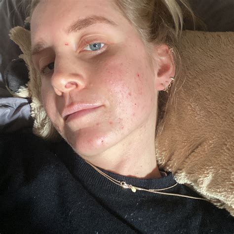 Meine Krebsgeschichte - Diagnose: Nebennierenrindenkarzinom ...