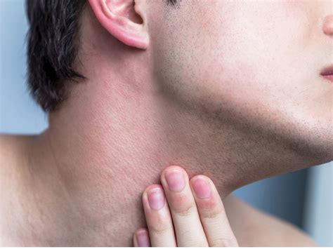 HOW TO PREVENT RAZOR BURN