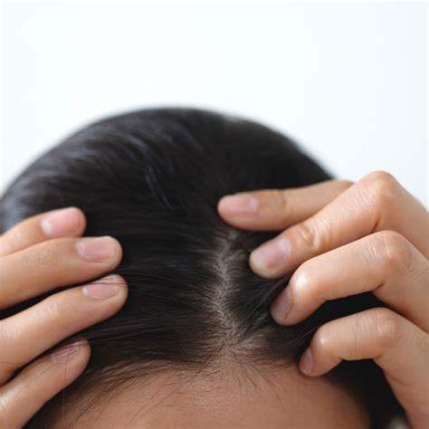 Best Natural Oils for Scalp Care — And How to Use Them