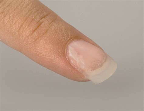 Why Are My Nails Lifting Off The Nail Bed at Nancy Jensen blog