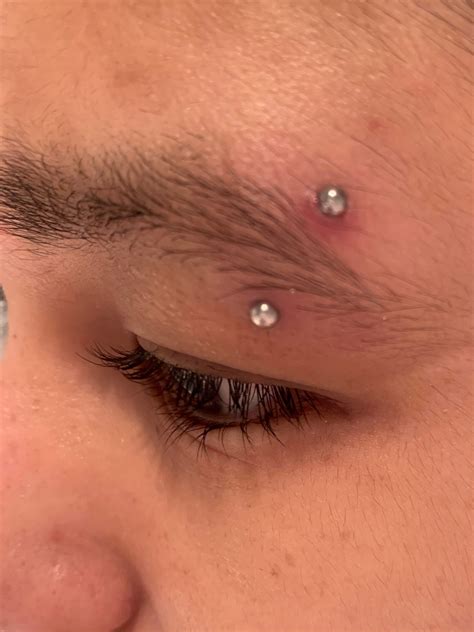 swollen and irritated eyebrow piercing. (info underneath post) : r/piercing