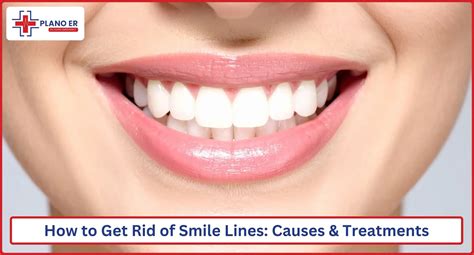 How to Get Rid of Smile Lines: Natural Remedies & Best Treatments