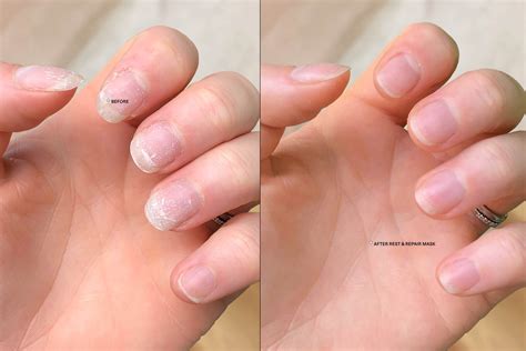 How to treat damaged nails, depending on your concern - Kester Black ...
