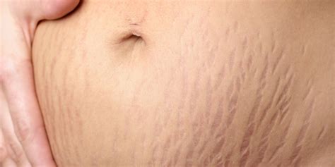 Mark Stretch's Instagram, Twitter & Facebook on IDCrawl