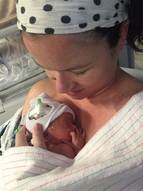 Mirrors Syndrome at Andre Mccann blog