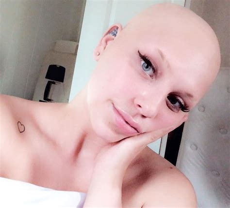 I grew my hair 2 feet long to give to my bald girlfriend — so she can’t break up with me | New ...