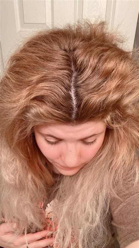 how to help 11yo stop pulling hair? : r/trichotillomania