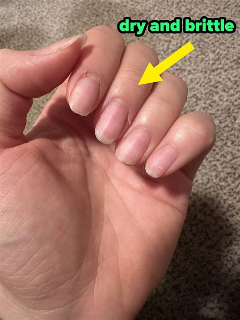 I Tried "Slugging" My Nails — And My Dry, Brittle Nails Have Never Been ...