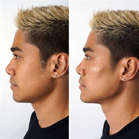Difference Between Male And Female Jawline at Emma Bushell blog