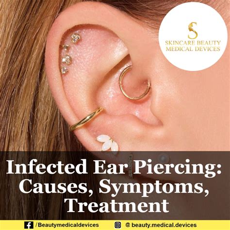 Infected Ear Piercing: Causes, Symptoms, Treatment