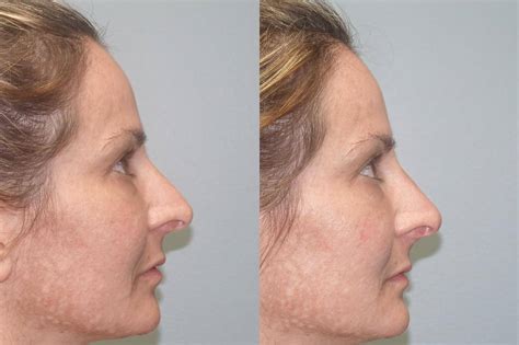 Facial asymmetry - Finger & Associates Plastic Surgery Center