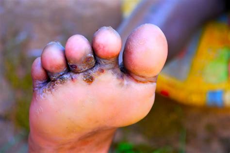 What Are Jiggers And What Do They Do at Nathan Mcnicholas blog