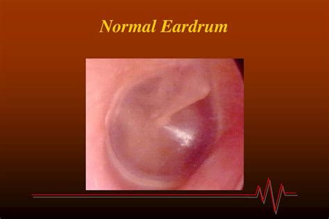 PPT - Comprehensive Introduction to History and Physical Exam ...