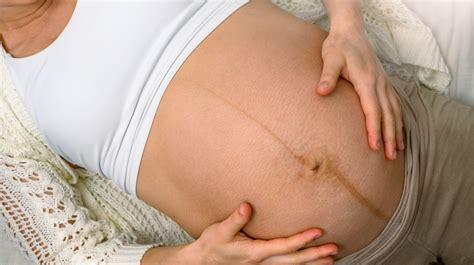 Linea nigra: find out what that pregnancy belly line means | GoodtoKnow