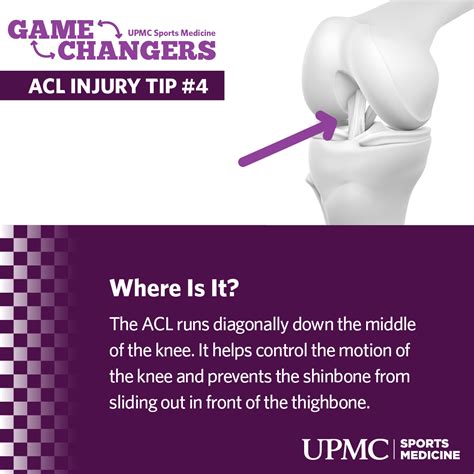 8 Tips to Prevent ACL Injuries | UPMC HealthBeat