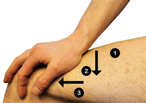 Adductor Tubercle Palpation