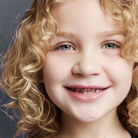 Lakeside Orthodontics | Trusted Orthodontists in Eagan & St. Paul