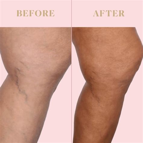 Endless Bronze™: Blur & Perfect Skin All Year | Nakery Beauty