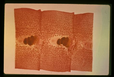 Spirometra mansonoides. Gravid proglottid. The gravid proglottid is ...