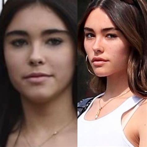 Madison Beer plastic surgery | Madison beer plastic surgery, Madison beer, Plastic surgery