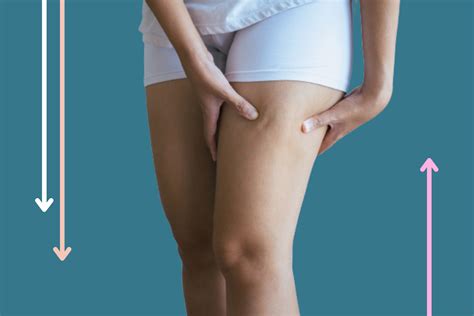 How To Get Rid Of Cottage Cheese Legs - Theatrecouple12