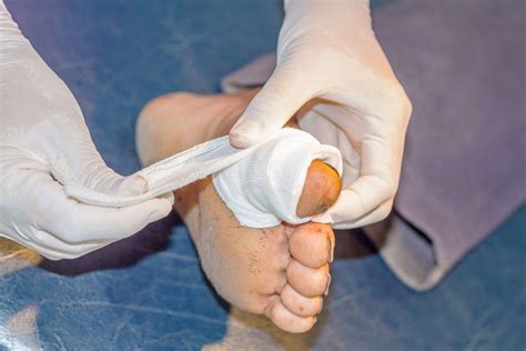 Managing Infection and Restoring Mobility Through Orthopedic Treatment ...