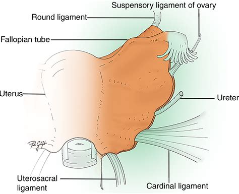 Suspensory Ovarian Ligament