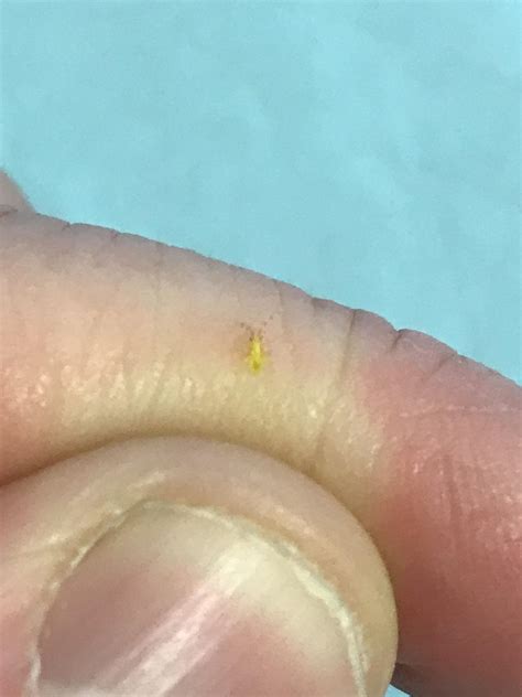 Bed bug or no? I was at the laundromat and this little yellowish ...