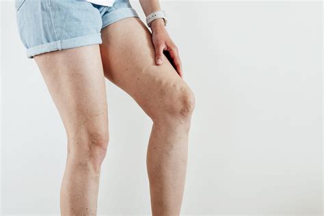 The Real Reasons Your Body Won't Stop Itching & How To Relief It