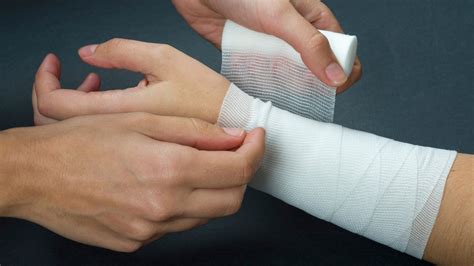 The Truth About Wrist Sprains: Symptoms, Grades, and Real Recovery Options - ANF