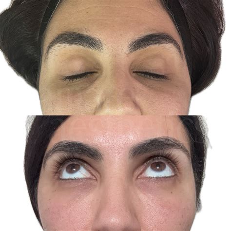 LA Skin Health | Amaju, MBA BSN 🇳🇬 | Exposure to the sun over time leads to damage that, along ...