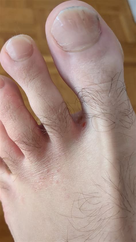 What Is this red point? : r/Dermatology