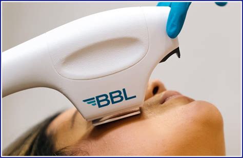 What is a BBL Device and How Does it Work? | SEAHEART GROUP