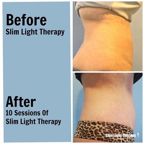 Red Light Therapy Weight Loss