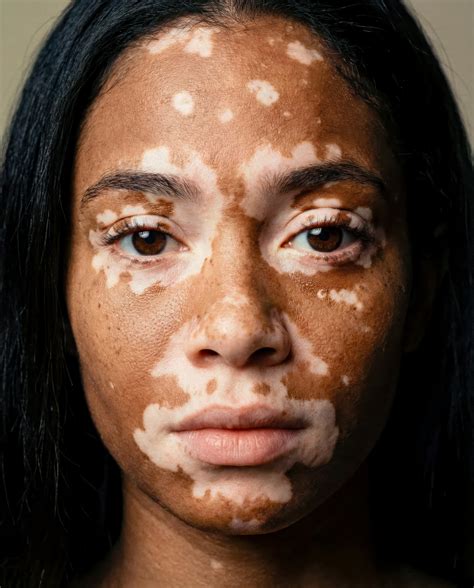 Identifying your skin type: A guide by Dr… | British Skin Foundation
