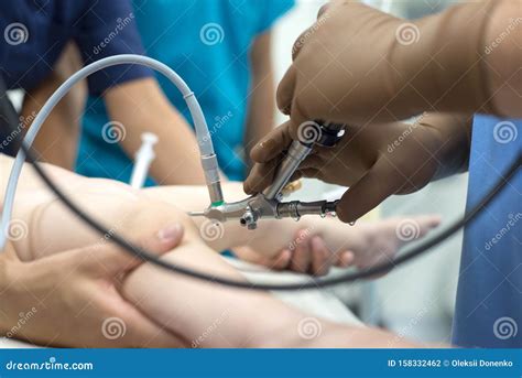 A Team Of Urologist Doctors Performing A Cystoscopy Using A Cystoscope. In A Sterile Operating ...