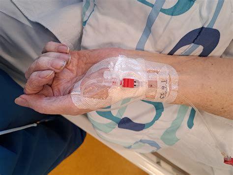 Arterial Line – Clinical Use, Indications and Complications - The ...