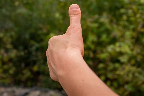 Causes Of Fingers Clubbing at Katina Woods blog