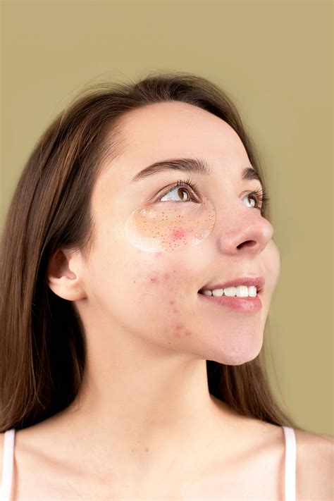 Acne Face Photos, Download The BEST Free Acne Face Stock Photos & HD Images