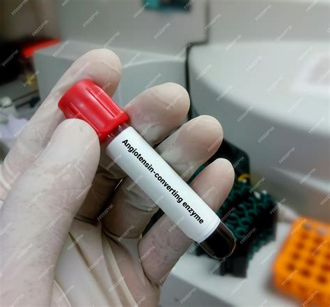 Premium Photo | Blood sample for angiotensin converting enzyme or ace ...